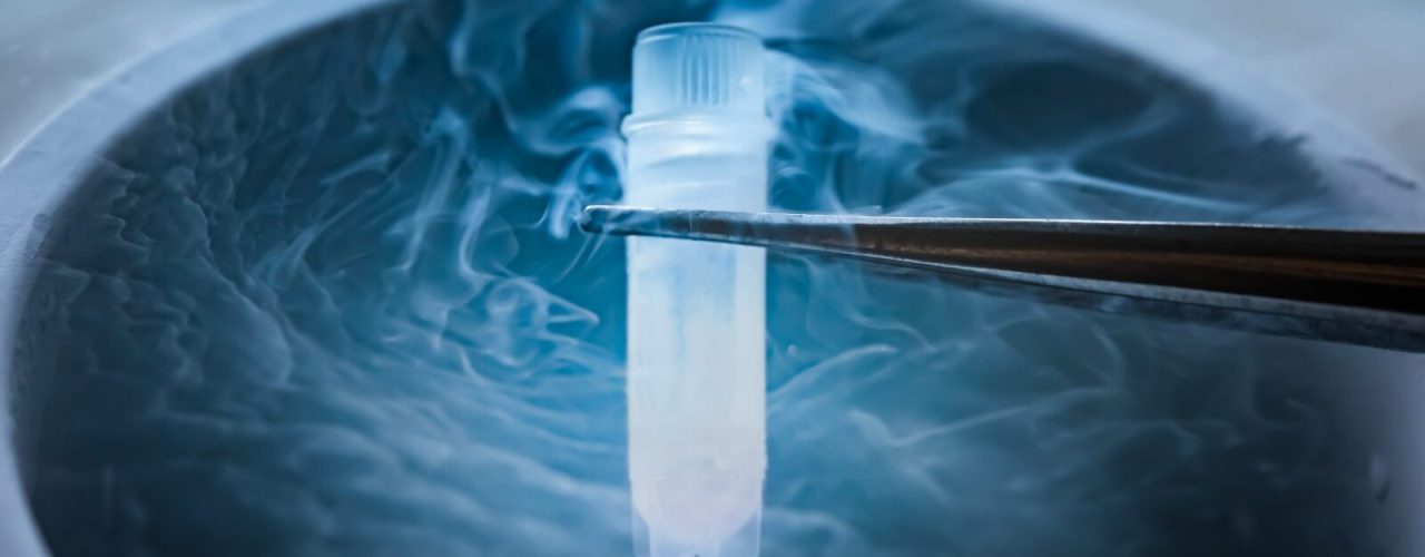 Cryopreservation,Of,Test,Tube,On,Liquid,Nitrogen,,A,Liquid,Nitrogen